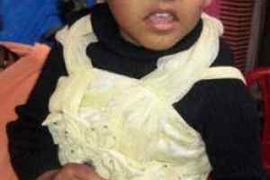 मुख्यमंत्री बाल हृदय उपचार योजना से जिया को मिला जीवनदान