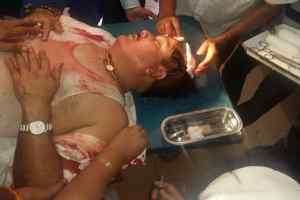 भाजपा सांसद अर्जुन सिंह का सिर फूटा