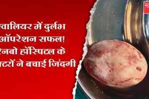 ग्वालियर के रेनबो हॉस्पिटल में दुर्लभ ऑपरेशन सफल, विशेषज्ञ टीम ने बचाई मरीज की जान